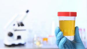 Synthetic Urine Test